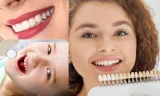 Diş Kliniği Randevu Süreci ve Hasta Deneyimi Neden Önemlidir?