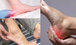 Topuk Ağrısı İçin Ortopedik Destek Ürünleri Hangileridir?