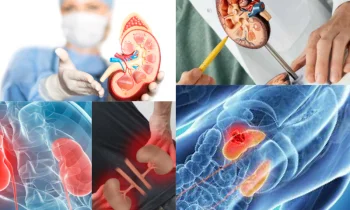 Böbrek Kanseri Belirtileri Nelerdir?