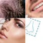 Rhinoplasty in Istanbul Prices