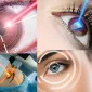 What is Laser Eye Surgery?